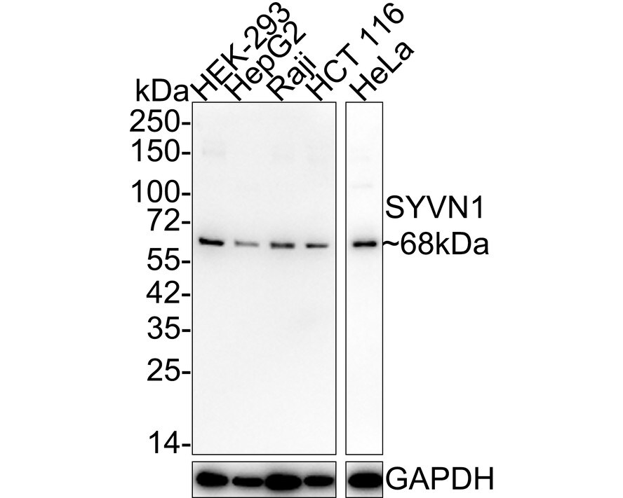 HRD1 Antibody (JE44-67) Western Blot: HRD1 Antibody (JE44-67) [NBP3-32991]