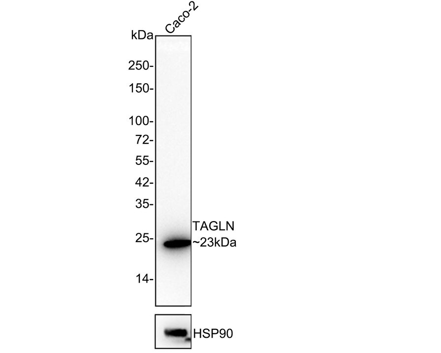 Transgelin/TAGLN/SM22 alpha Antibody (JE60-72) Western Blot: Transgelin/TAGLN/SM22 alpha Antibody (JE60-72) [NBP3-32992]