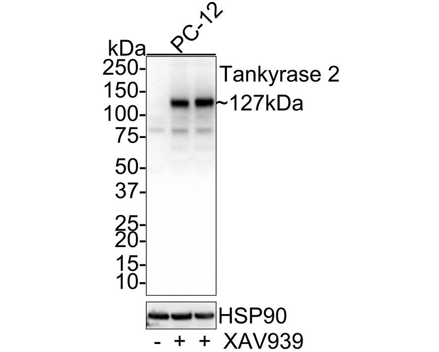 TNKS2 Antibody (PSH0-53)