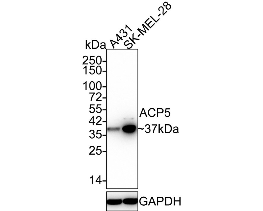 TRACP/PAP/ACP5 Antibody (JE35-95) Western Blot: TRACP/PAP/ACP5 Antibody (JE35-95) [NBP3-32994]