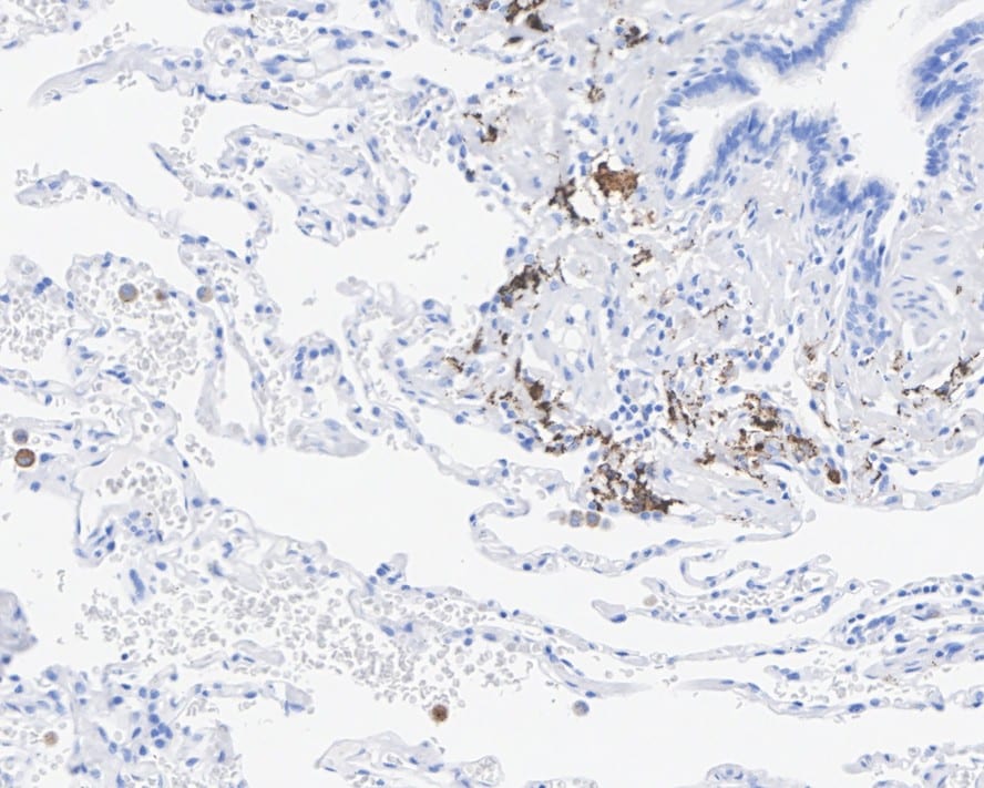 TRACP/PAP/ACP5 Antibody (JE35-95)