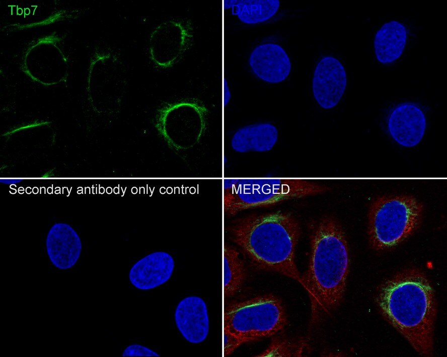 Tbp7 Antibody (JE62-72)