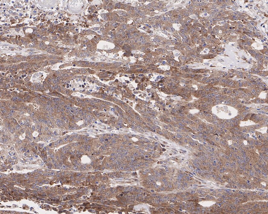Tbp7 Antibody (JE62-72)