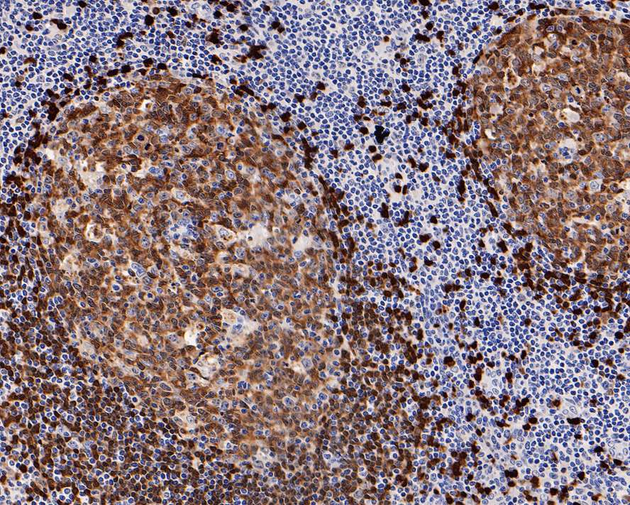 TCL1A Antibody (PD00-94)