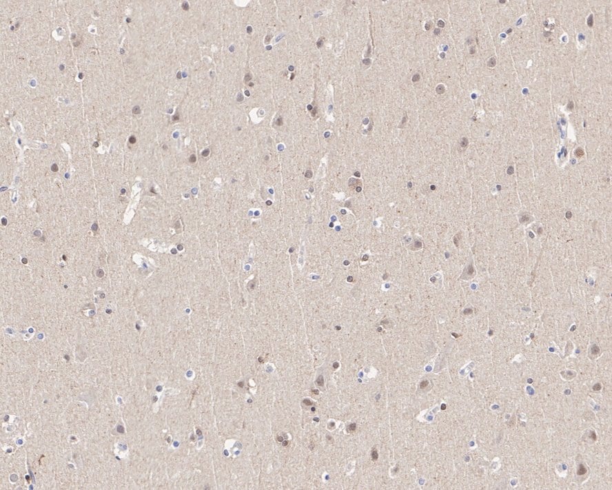 TDP1 Antibody (PSH0-93)