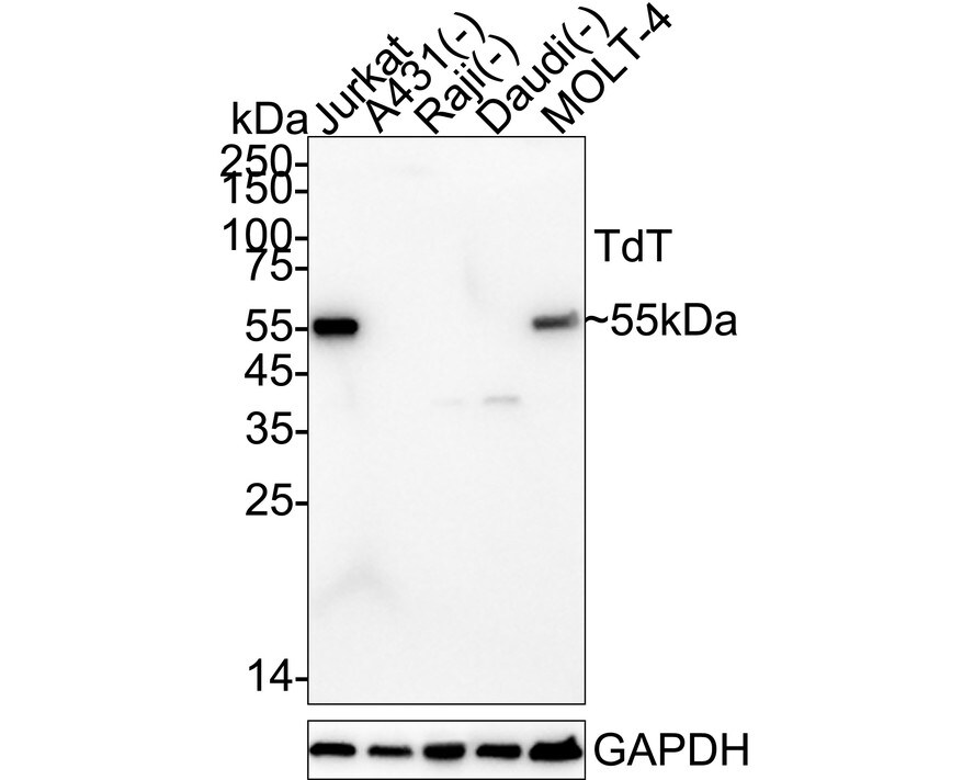 TdT Antibody (PD01-00) Western Blot: TdT Antibody (PD01-00) [NBP3-33003]