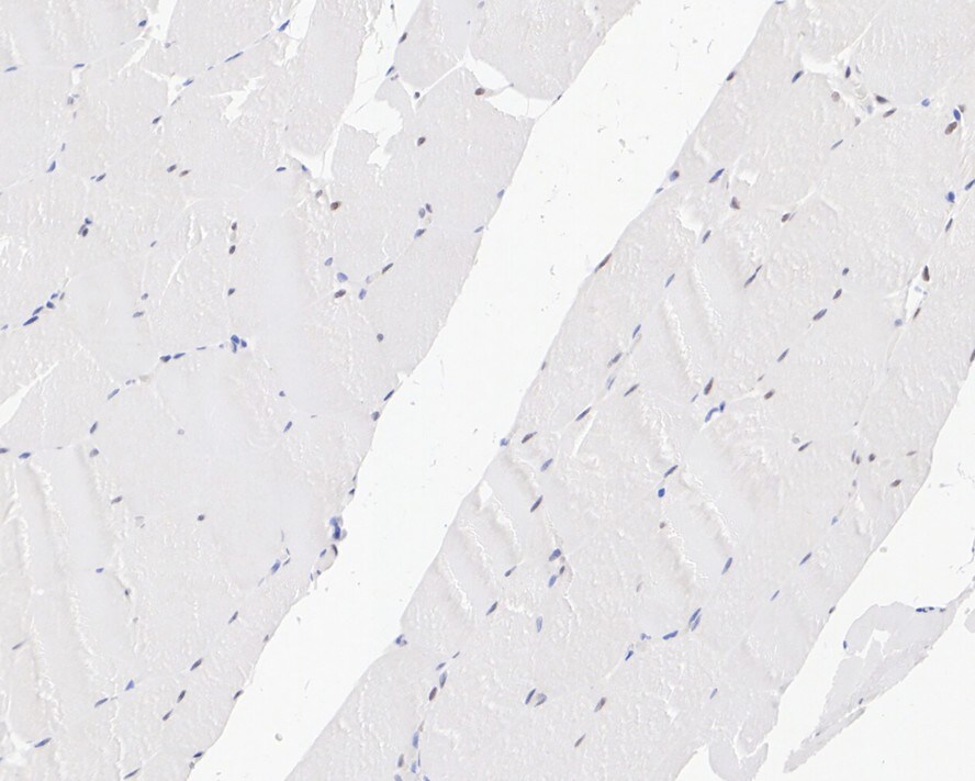 TEAD1 Antibody (JE45-37)