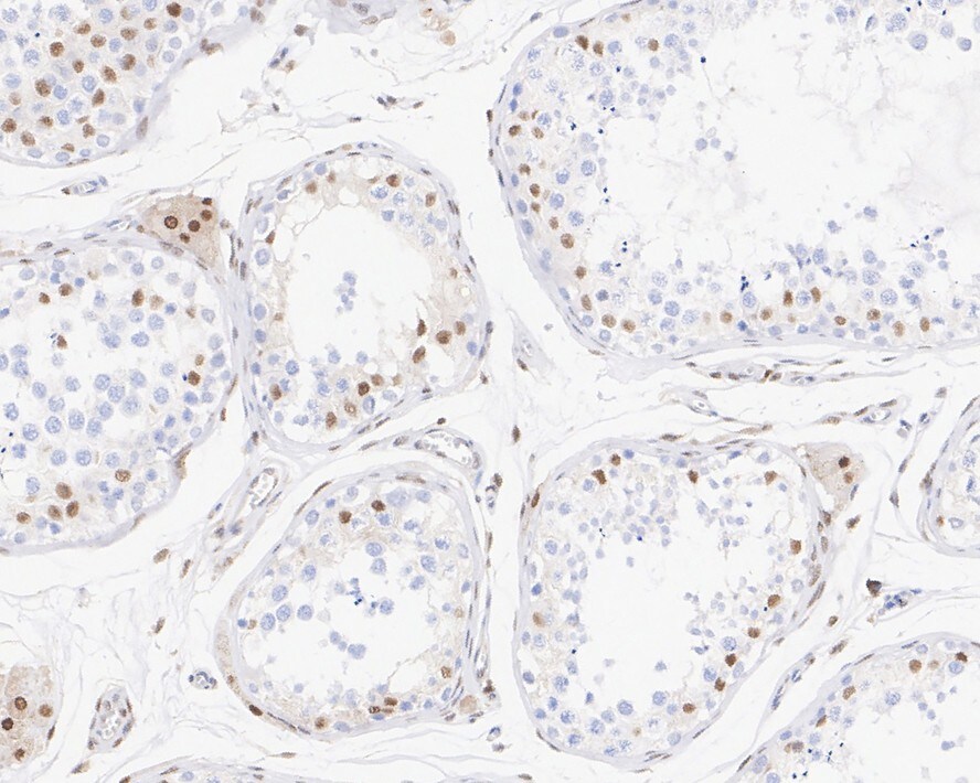 Transcription factor E3 Antibody (JE60-60)