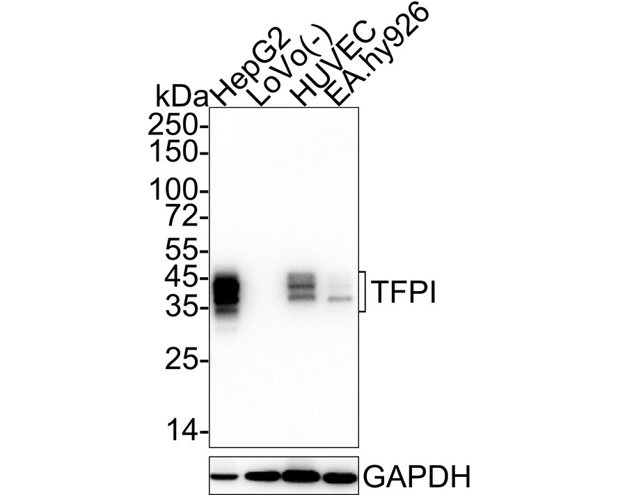 TFPI Antibody (JE40-58) Western Blot: TFPI Antibody (JE40-58) [NBP3-33007]