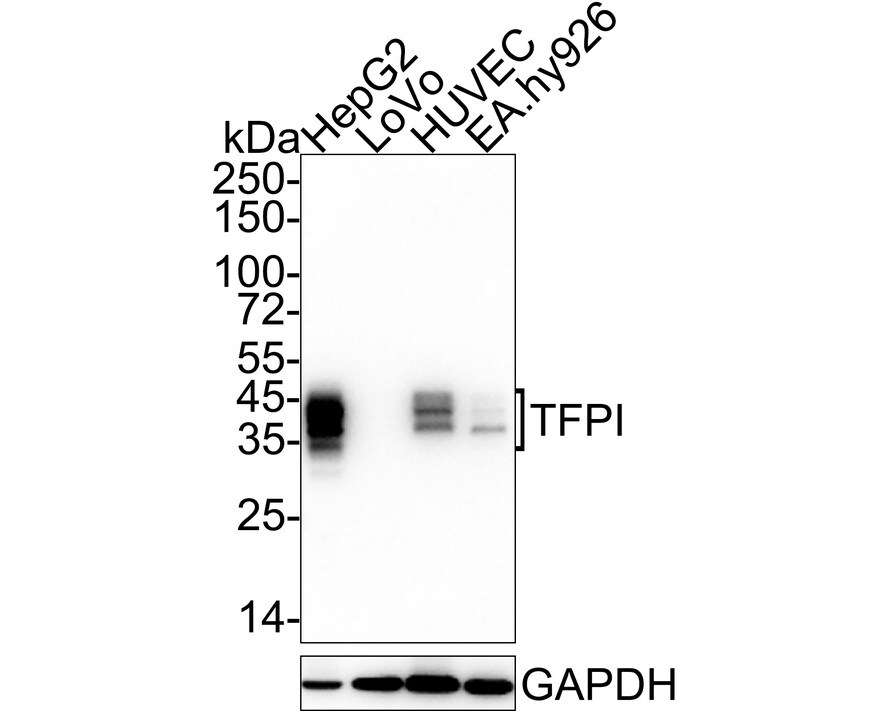 TFPI Antibody (JE40-58)