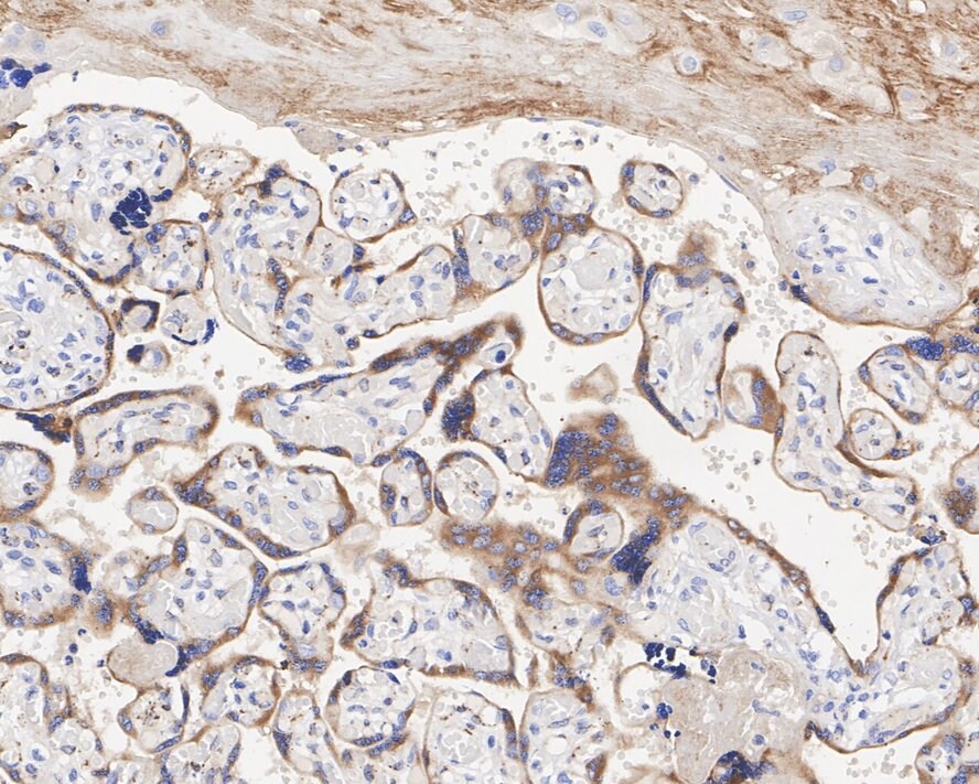 TFPI Antibody (JE40-58)