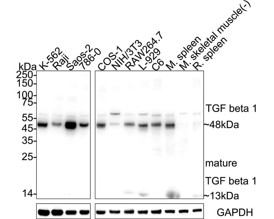 TGF-beta 1 Antibody (PD00-17) Western Blot: TGF-beta 1 Antibody (PD00-17) [NBP3-33008]