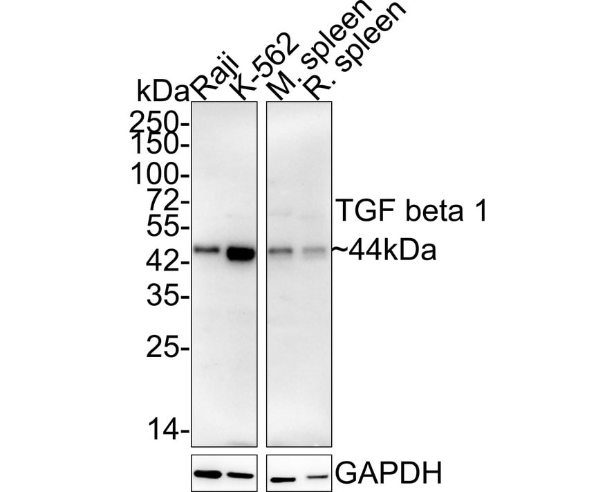 TGF-beta 1 Antibody (PD00-17)