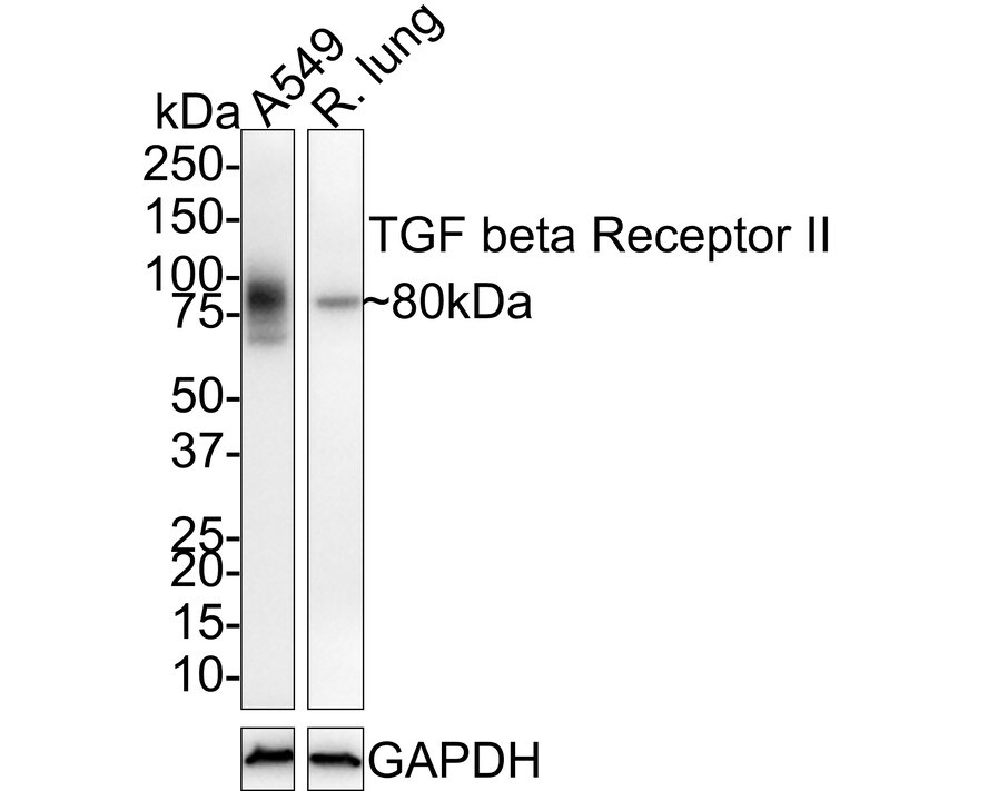 TGF-beta RII Antibody (JE59-90)