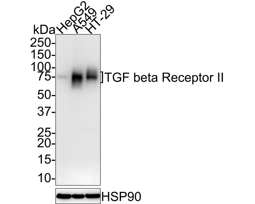 TGF-beta RII Antibody (PSH01-50)