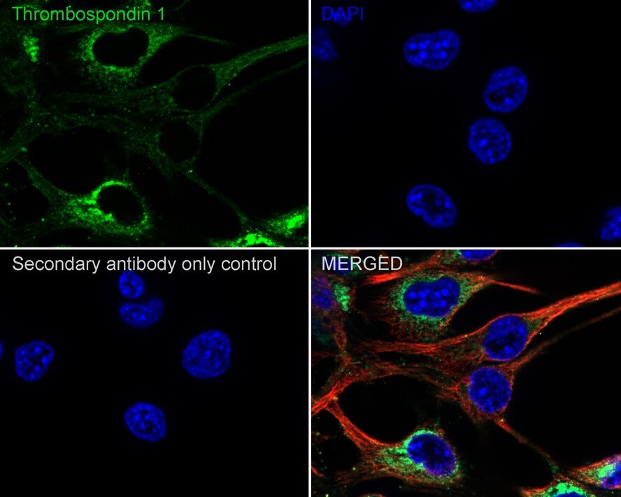 Thrombospondin-1 Antibody (PSH02-97)