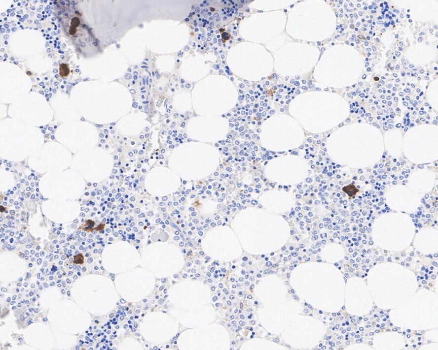 Thrombospondin-1 Antibody (PSH02-97)