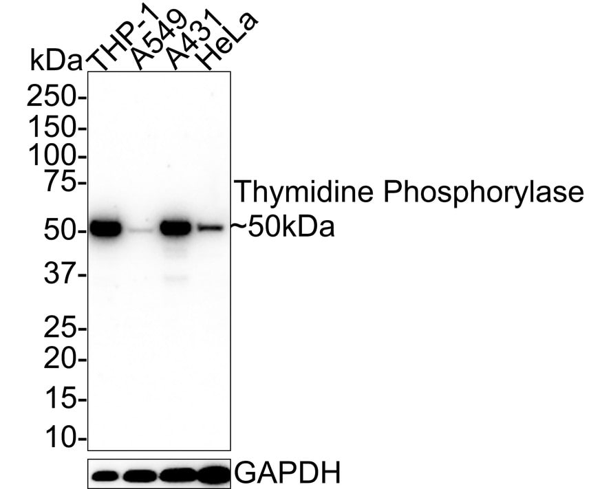PD-ECGF/Thymidine Phosphorylase Antibody (A1A10-R) Western Blot: PD-ECGF/Thymidine Phosphorylase Antibody (A1A10-R) [NBP3-33013]