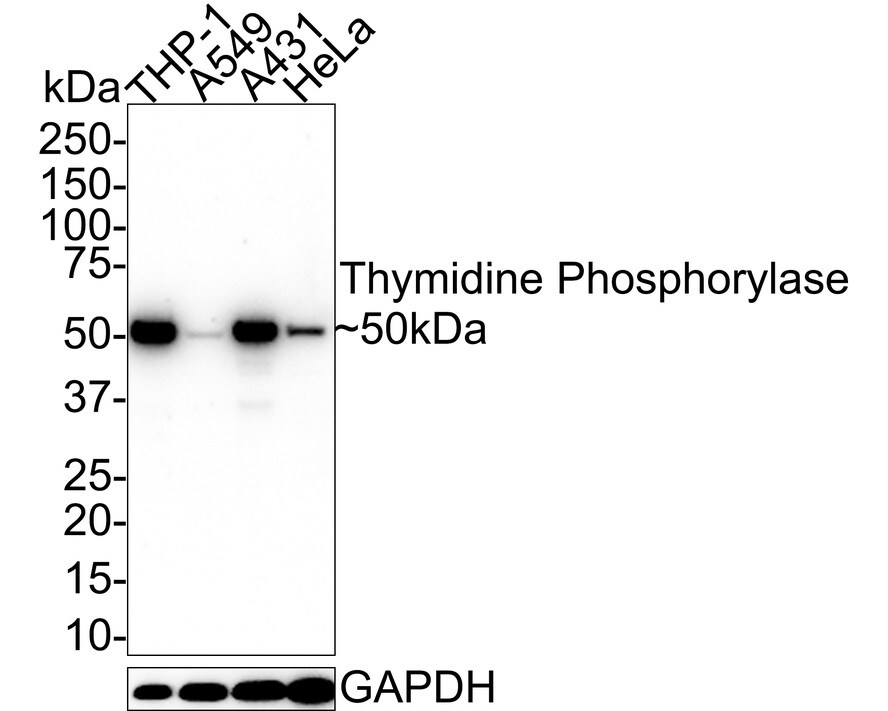 PD-ECGF/Thymidine Phosphorylase Antibody (A1A10-R)