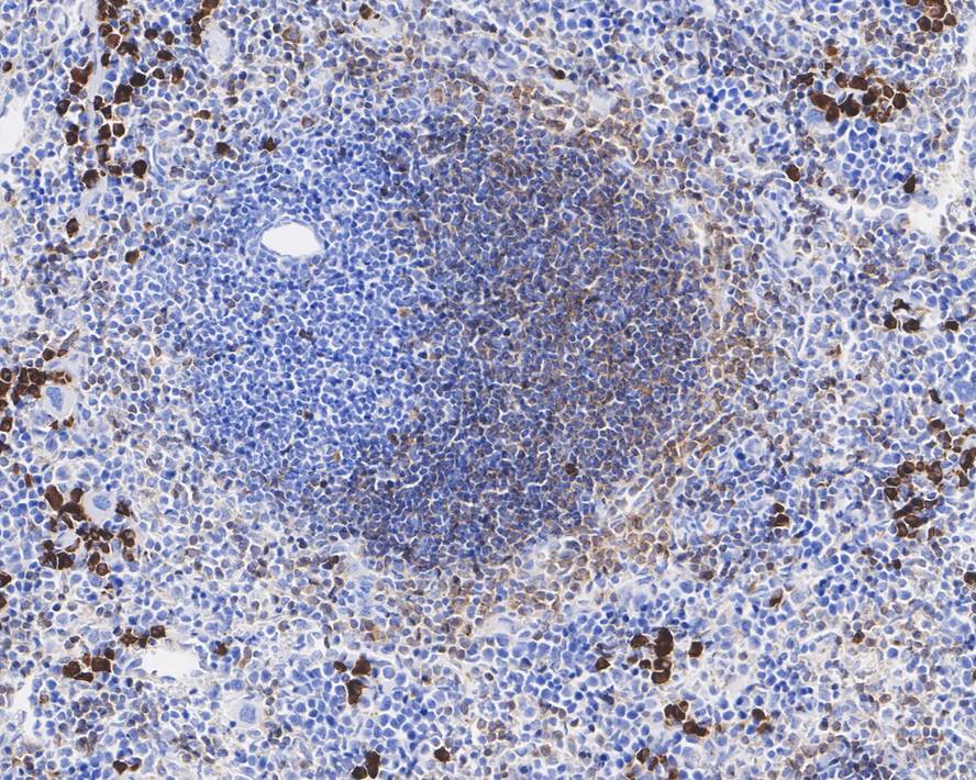 PD-ECGF/Thymidine Phosphorylase Antibody (A1A10-R)