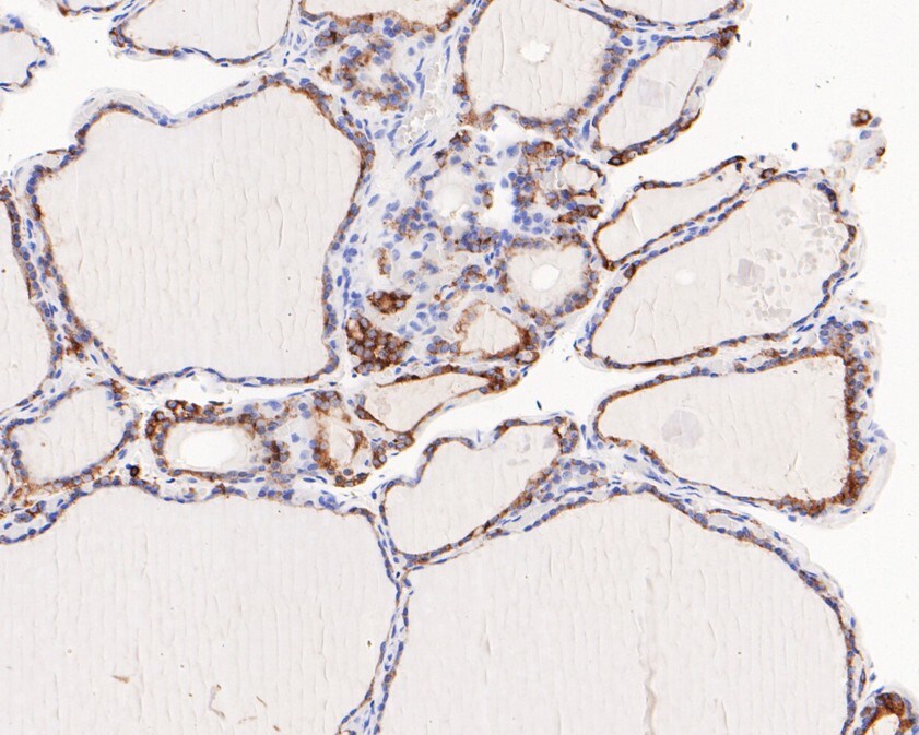Thyroid Peroxidase Antibody (JE60-40)