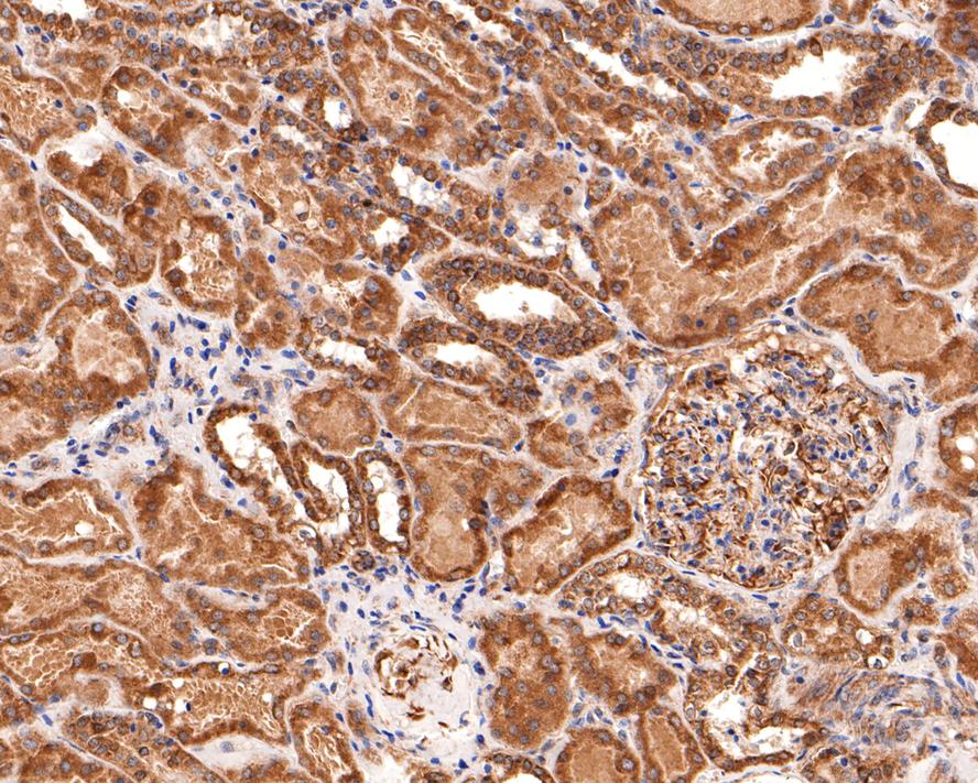 TIMM23 Antibody
