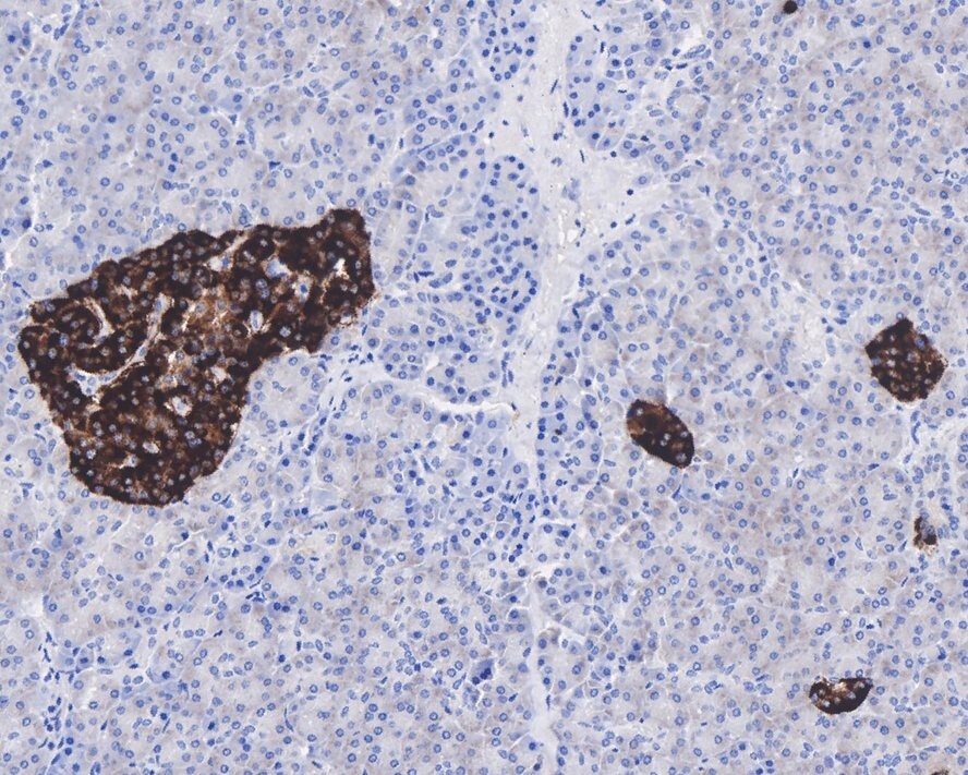 TIMP-1 Antibody (JE59-72)