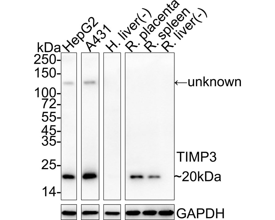 TIMP-3 Antibody (PSH04-41) Western Blot: TIMP-3 Antibody (PSH04-41) [NBP3-33023]
