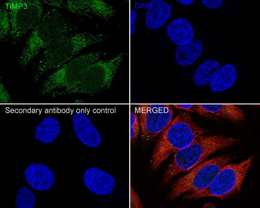 TIMP-3 Antibody (PSH04-41)