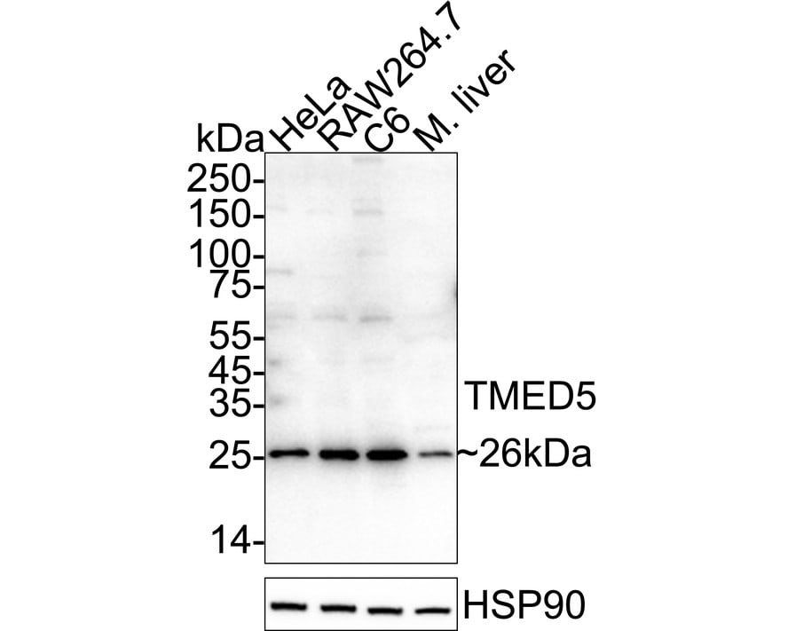 TMED5 Antibody Western Blot: TMED5 Antibody [NBP3-33025]