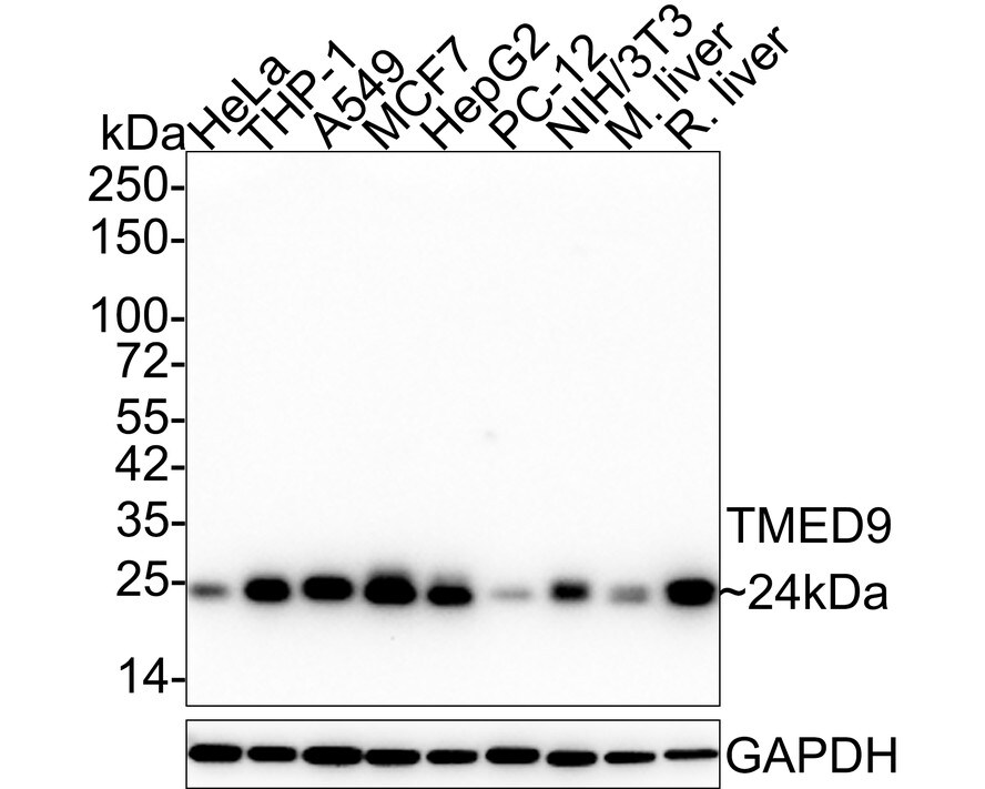 TMED9 Antibody (A9A8) Western Blot: TMED9 Antibody (A9A8) [NBP3-33026]