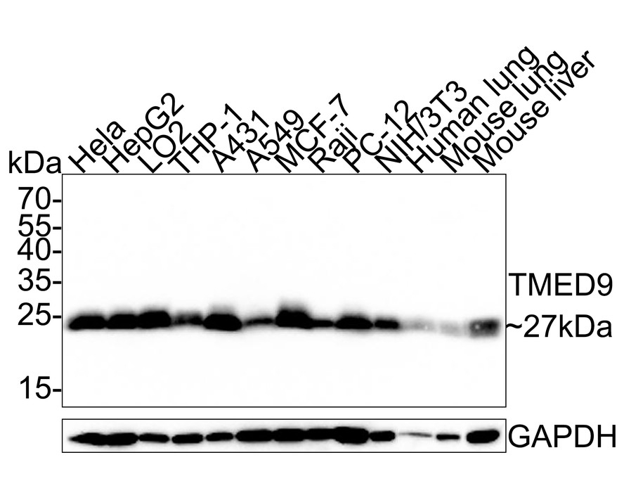 TMED9 Antibody (A9A7-R) Western Blot: TMED9 Antibody (A9A7-R) [NBP3-33027]