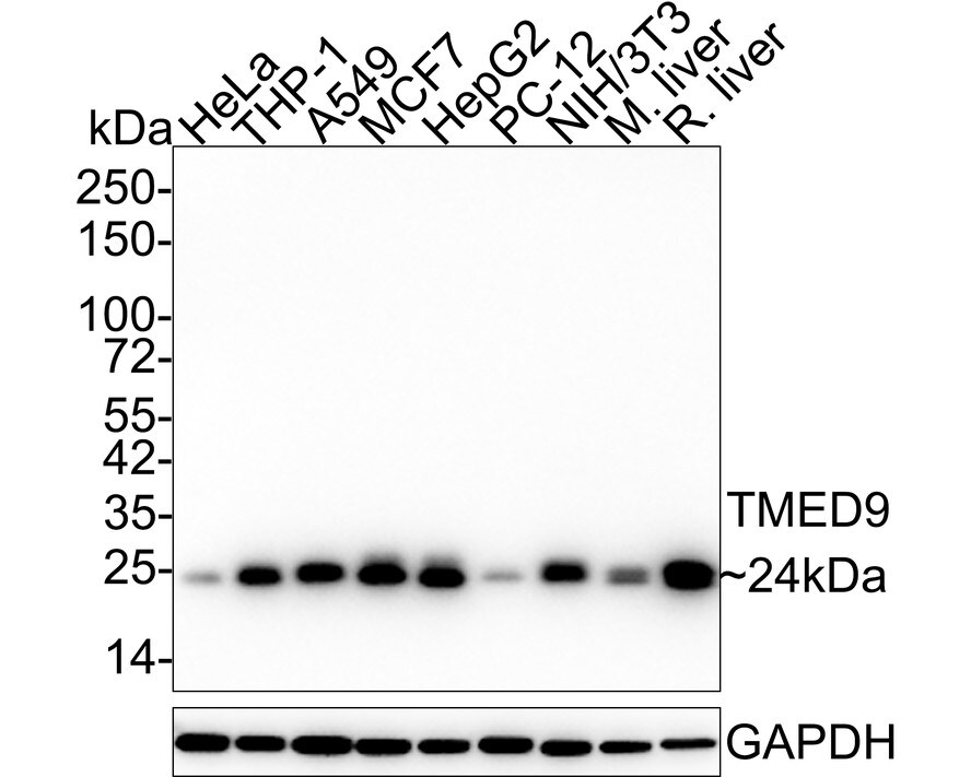 TMED9 Antibody (A9A8-R) Western Blot: TMED9 Antibody (A9A8-R) [NBP3-33028]