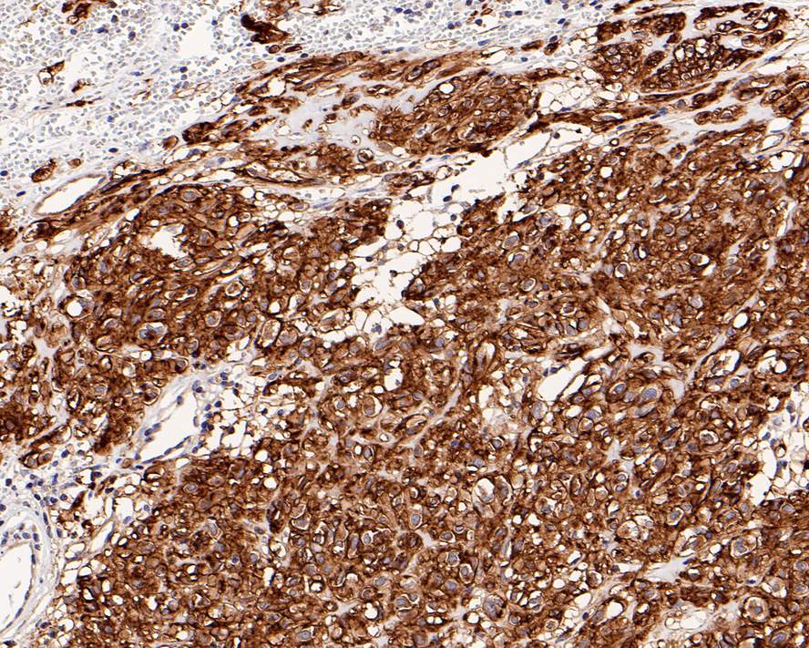 DOG1/TMEM16A Antibody (PO00-27)