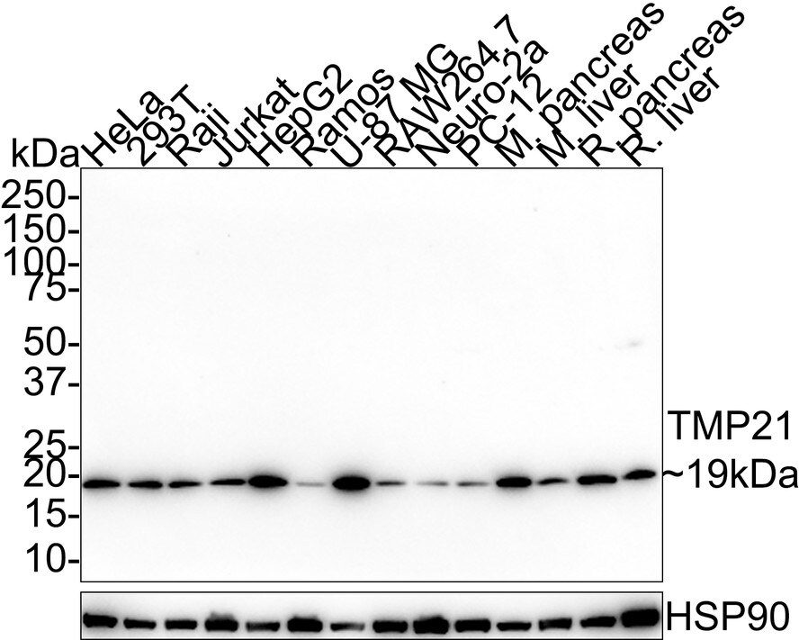 Tmp21/p23 Antibody (PSH01-40) Western Blot: Tmp21/p23 Antibody (PSH01-40) [NBP3-33030]