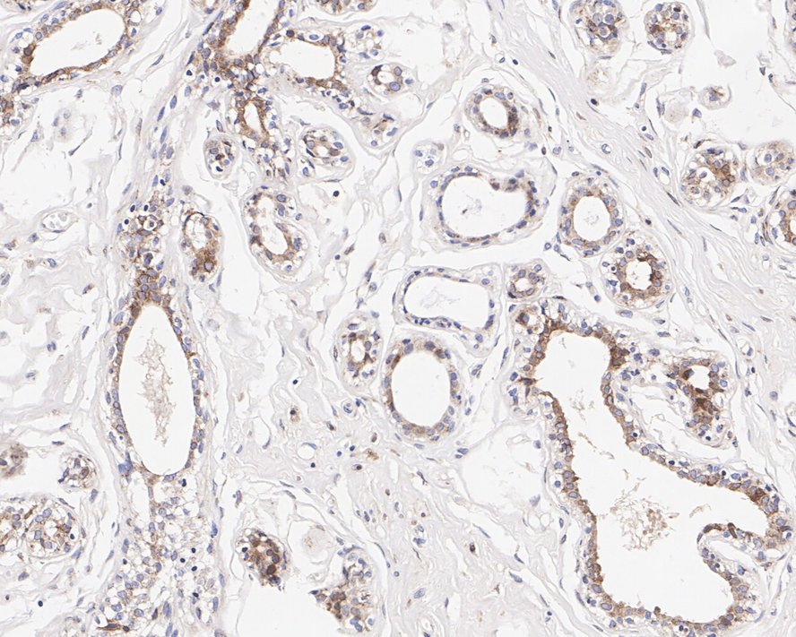 Tmp21/p23 Antibody (PSH01-40)