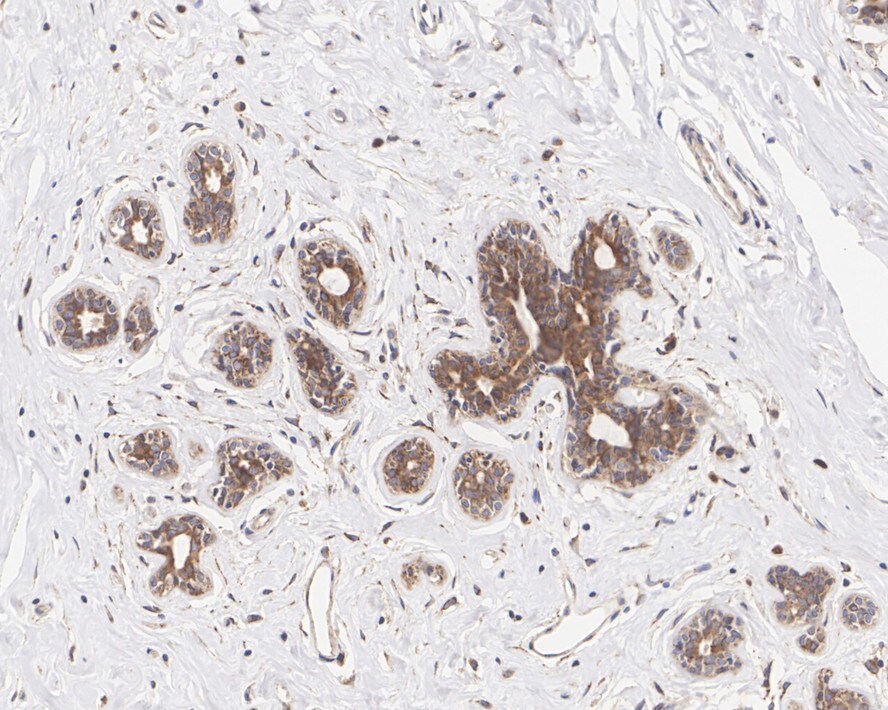 Tmp21/p23 Antibody (PSH01-41)