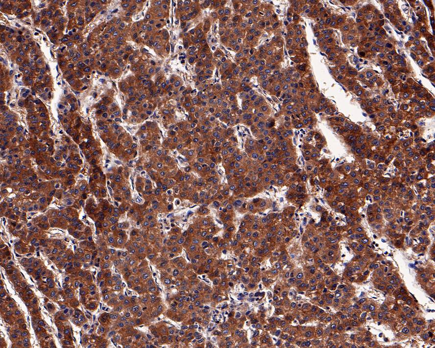 Tensin 4/CTEN Antibody (PD00-95)