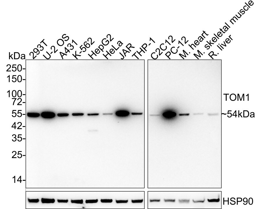 TOM1 Antibody (PSH03-38) Western Blot: TOM1 Antibody (PSH03-38) [NBP3-33035]