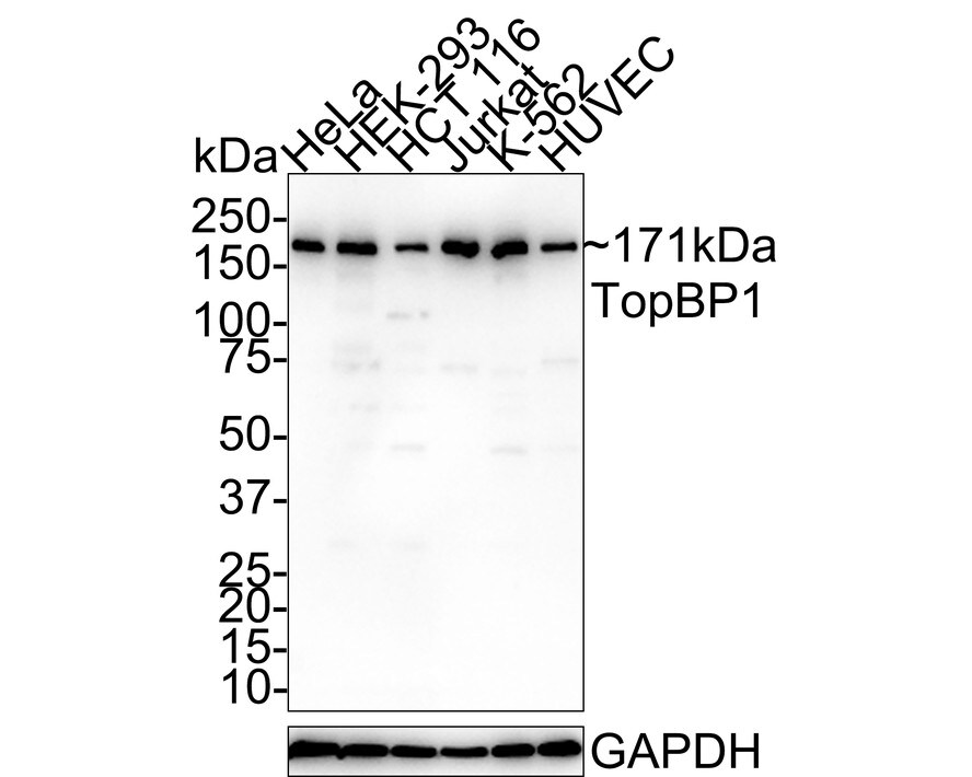 TopBP1 Antibody (PSH01-14) Western Blot: TopBP1 Antibody (PSH01-14) [NBP3-33036]
