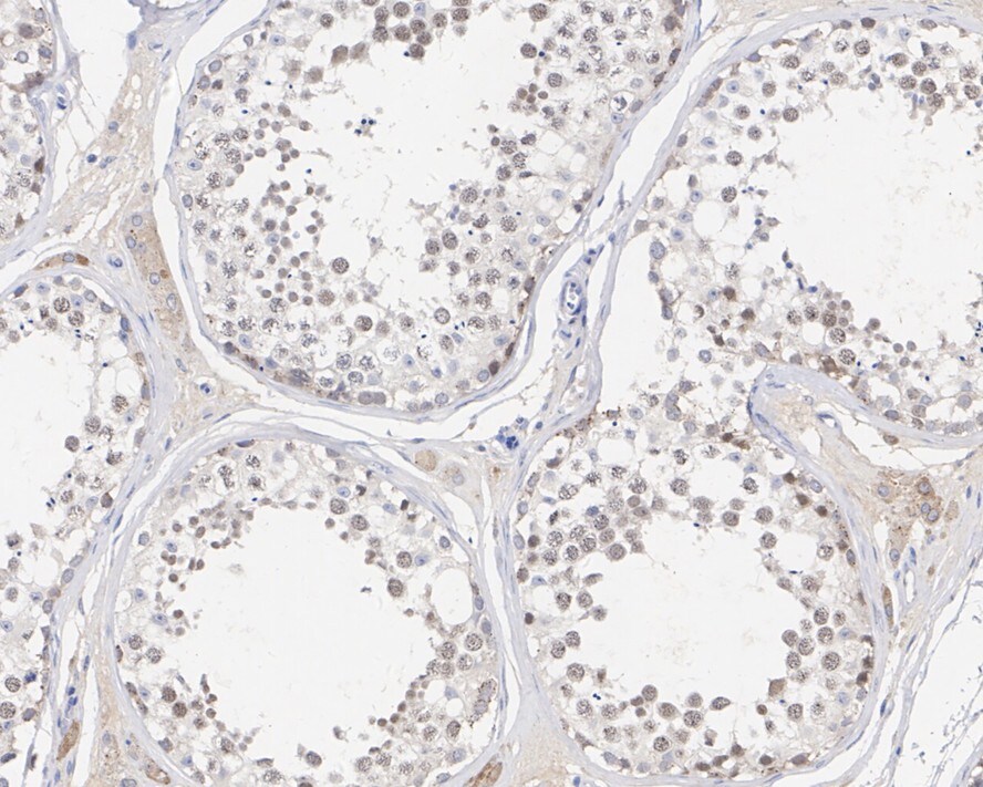TopBP1 Antibody (PSH01-14)