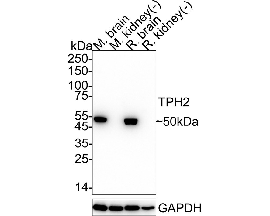 Tryptophan hydroxylase 2 Antibody (PSH04-89) Western Blot: Tryptophan hydroxylase 2 Antibody (PSH04-89) [NBP3-33037]