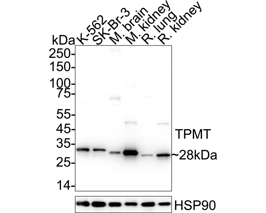 TPMT Antibody (JE64-09) Western Blot: TPMT Antibody (JE64-09) [NBP3-33038]