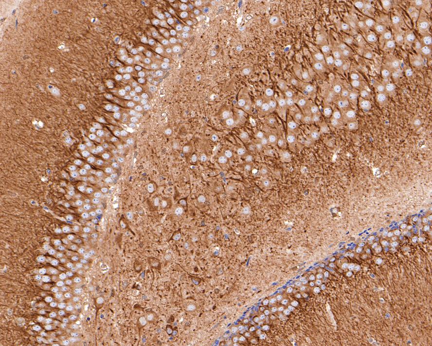 TPMT Antibody (JE64-09)