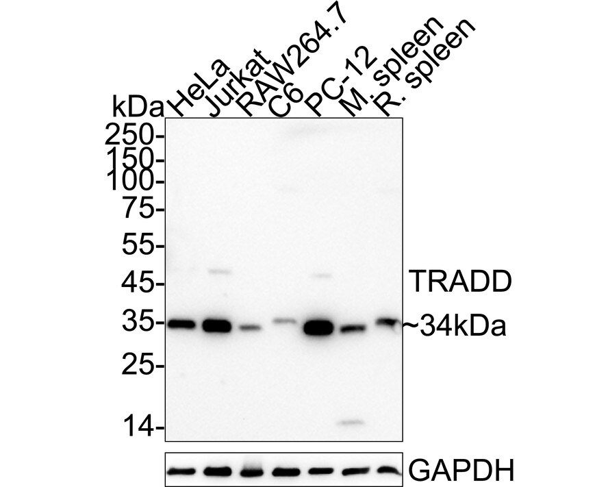 TRADD Antibody (JE32-60) Western Blot: TRADD Antibody (JE32-60) [NBP3-33041]