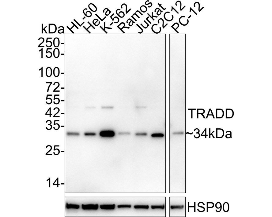 TRADD Antibody (JE32-60) Western Blot: TRADD Antibody (JE32-60) [NBP3-33041]