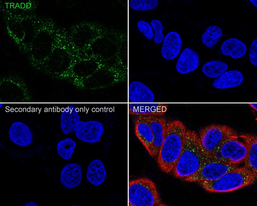 TRADD Antibody (JE32-60)