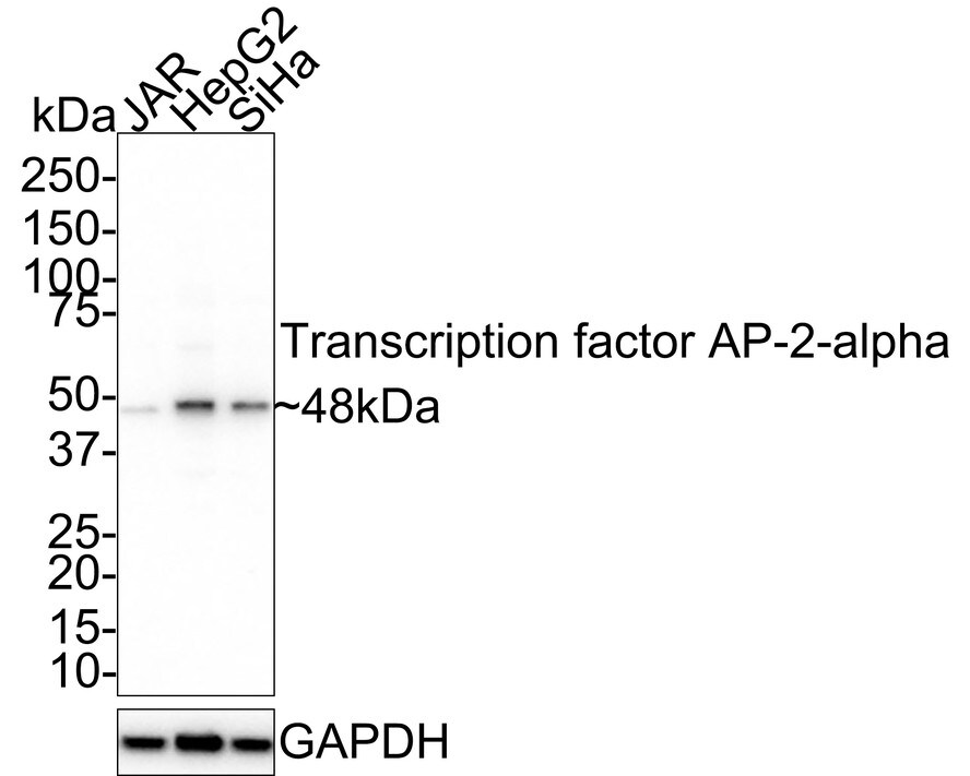 AP2 alpha Antibody (PSH02-05)