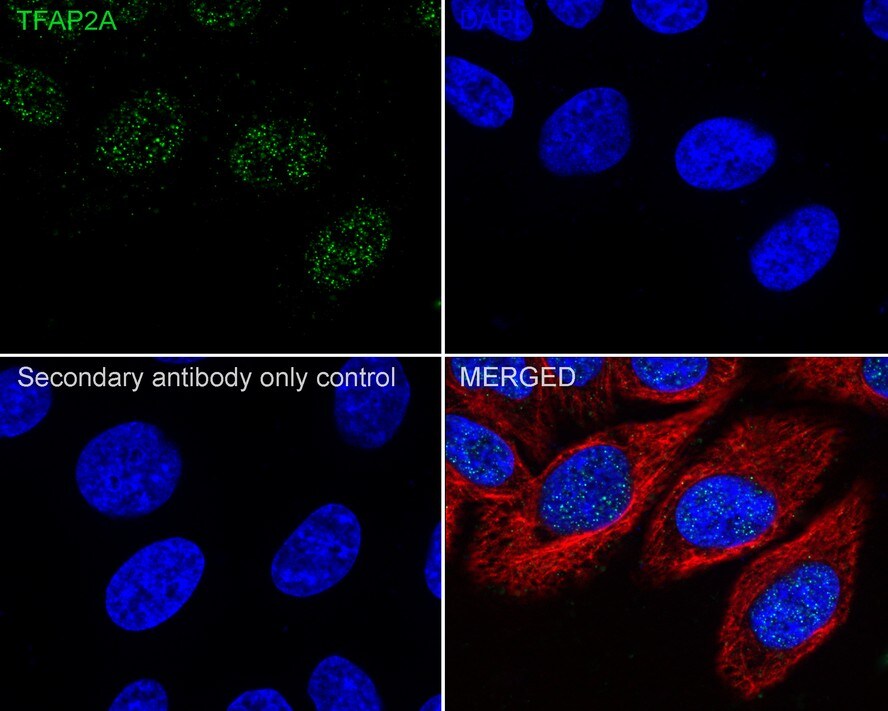 AP2 alpha Antibody (PSH02-05)