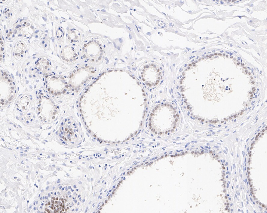 AP2 alpha Antibody (PSH02-05)